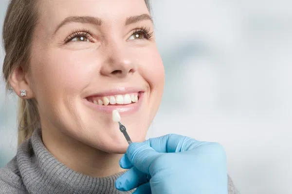 A smiling patient sits while a dental professional in blue gloves holds a veneer shade guide to her teeth, carefully matching the color for a natural and aesthetically pleasing result.