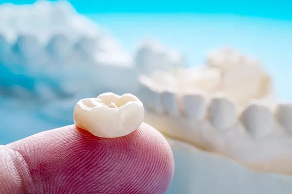 Close-up of a custom-made dental crown resting on a fingertip, highlighting the precision and natural appearance achieved through CEREC technology at Salt Flats Dentistry.
